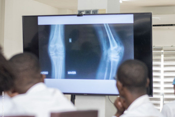 La première semaine scientifique de l’Hémophilie dynamise la prise en charge au Bénin