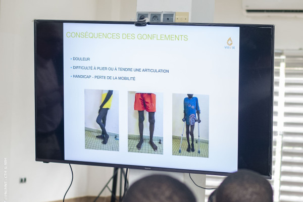 La première semaine scientifique de l’Hémophilie dynamise la prise en charge au Bénin