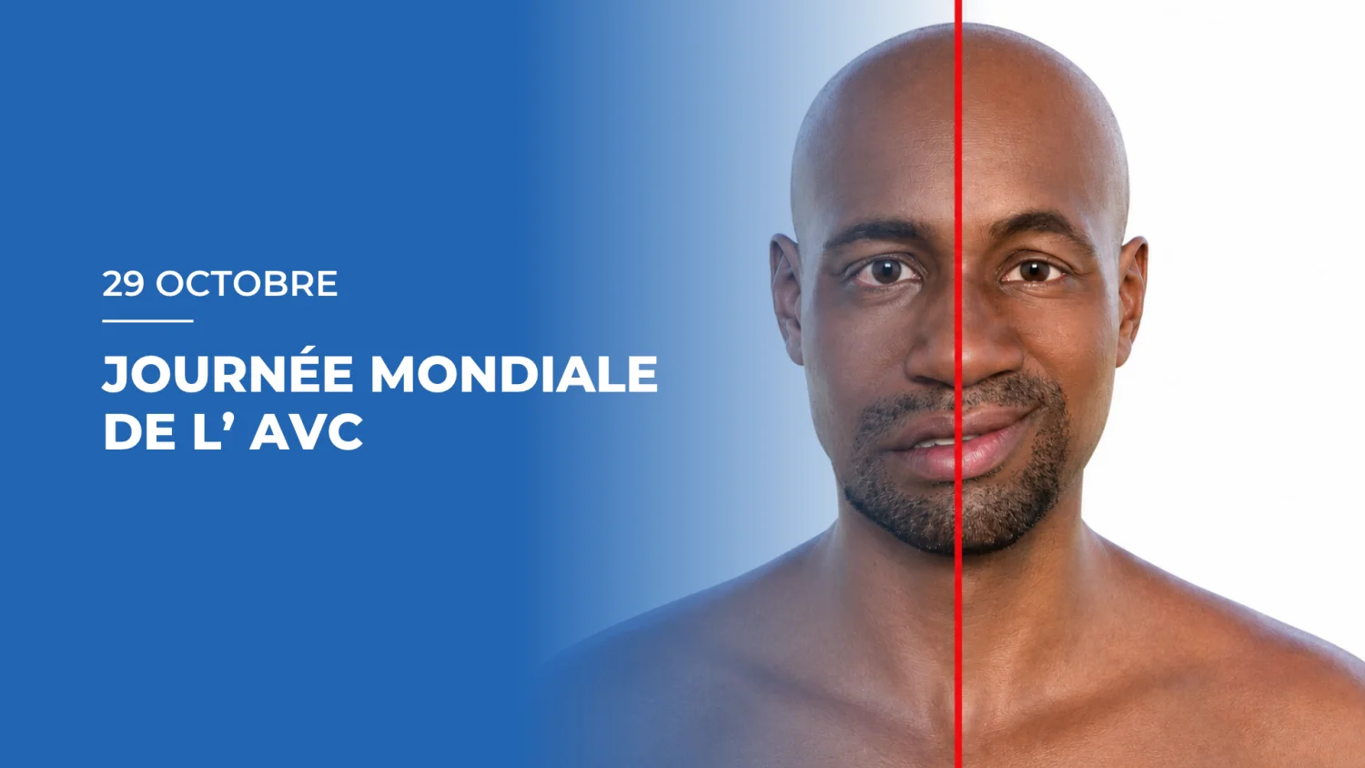 Journée mondiale de l'AVC 2026 : prévenir le risque, reconnaître l’urgence