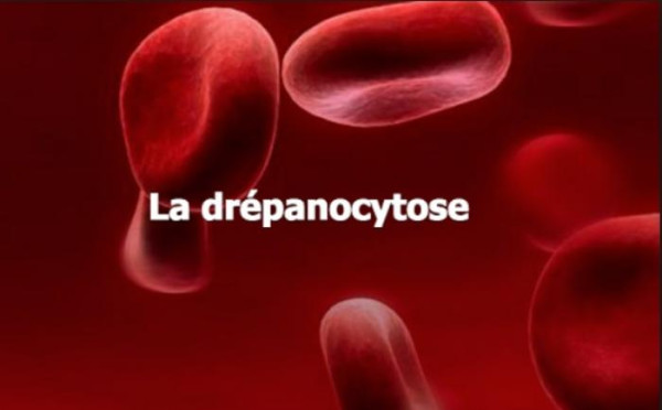 Journée mondiale des personnes atteintes de la drépanocytose