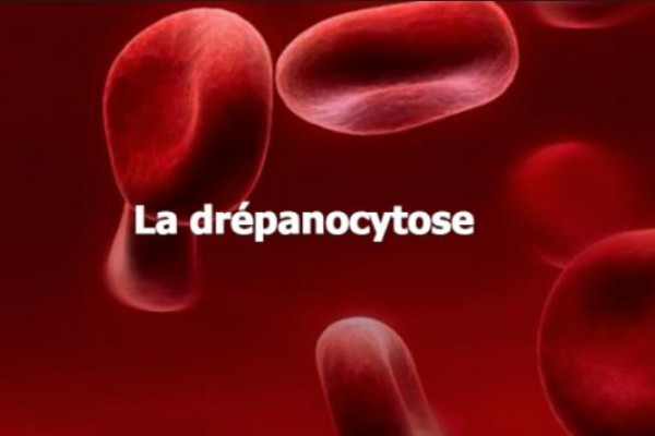 Journée mondiale des personnes atteintes de la drépanocytose