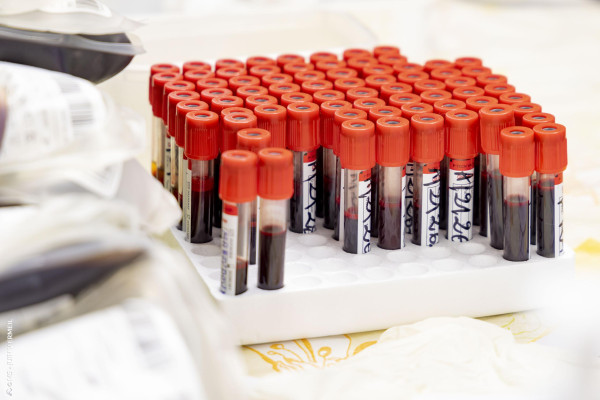 TOUT COTONOU MARCHE CONTRE LA DRÉPANOCYTOSE : une mobilisation forte pour briser le silence